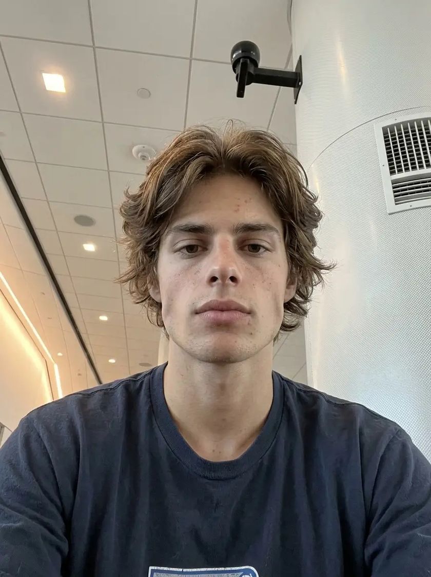 After: the same face, rested and set