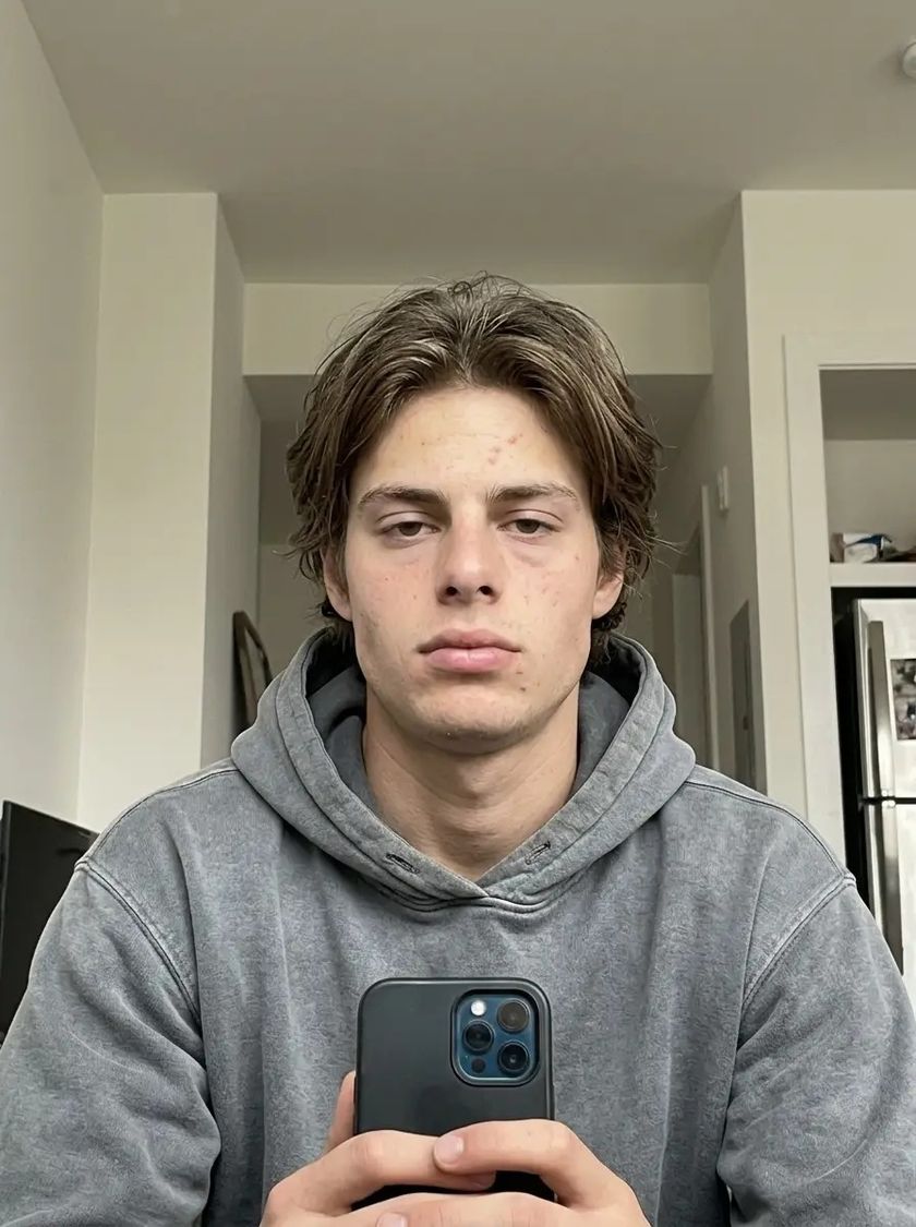 Before: puffy eyes, dull skin, soft jaw, head forward